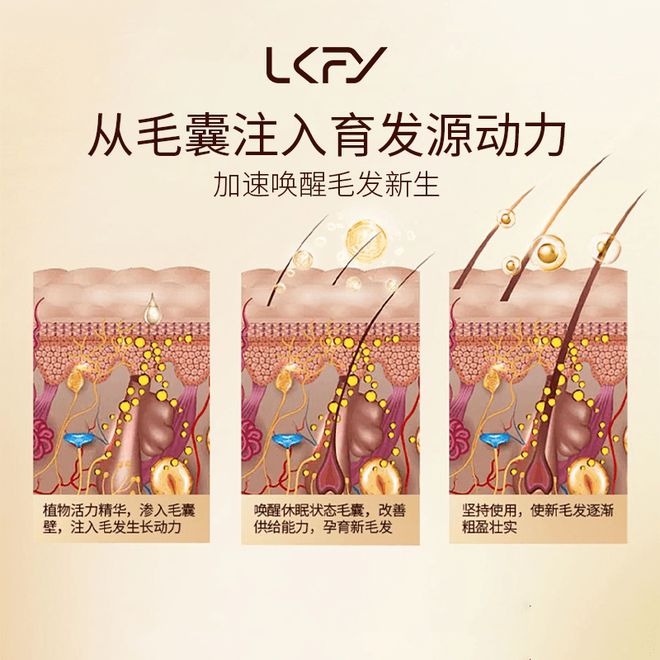 凯发手机app 防脱洗发水哪个牌子的效果
